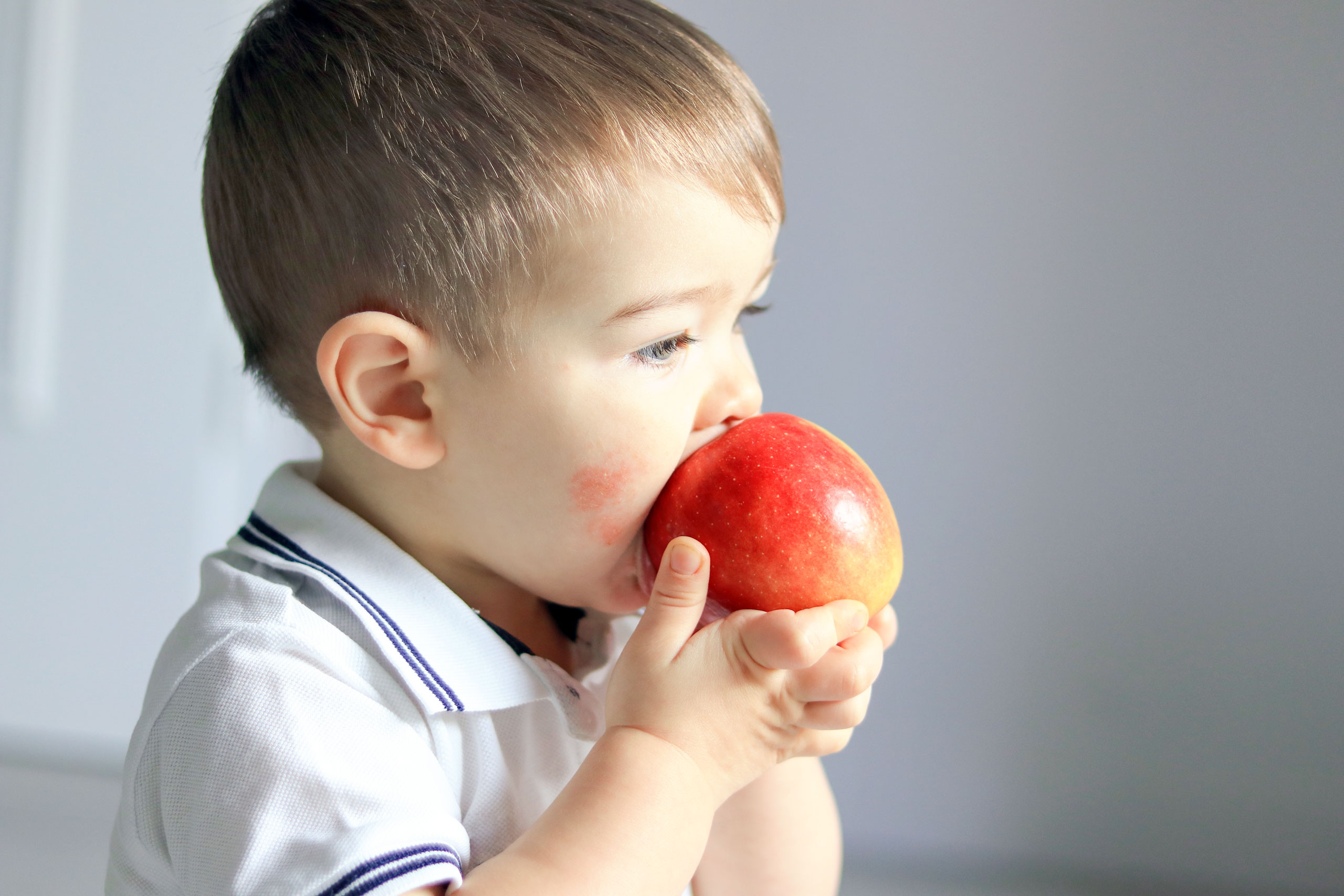 allcon-ratgeber-neurodermitis-bei-kindern-ernaehrung